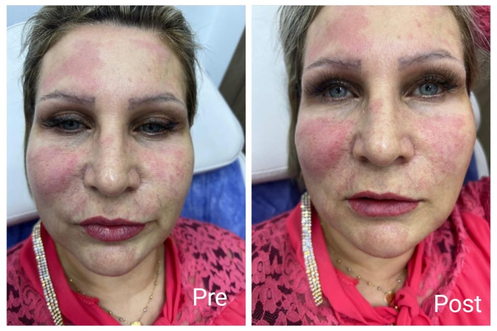 Profile session result